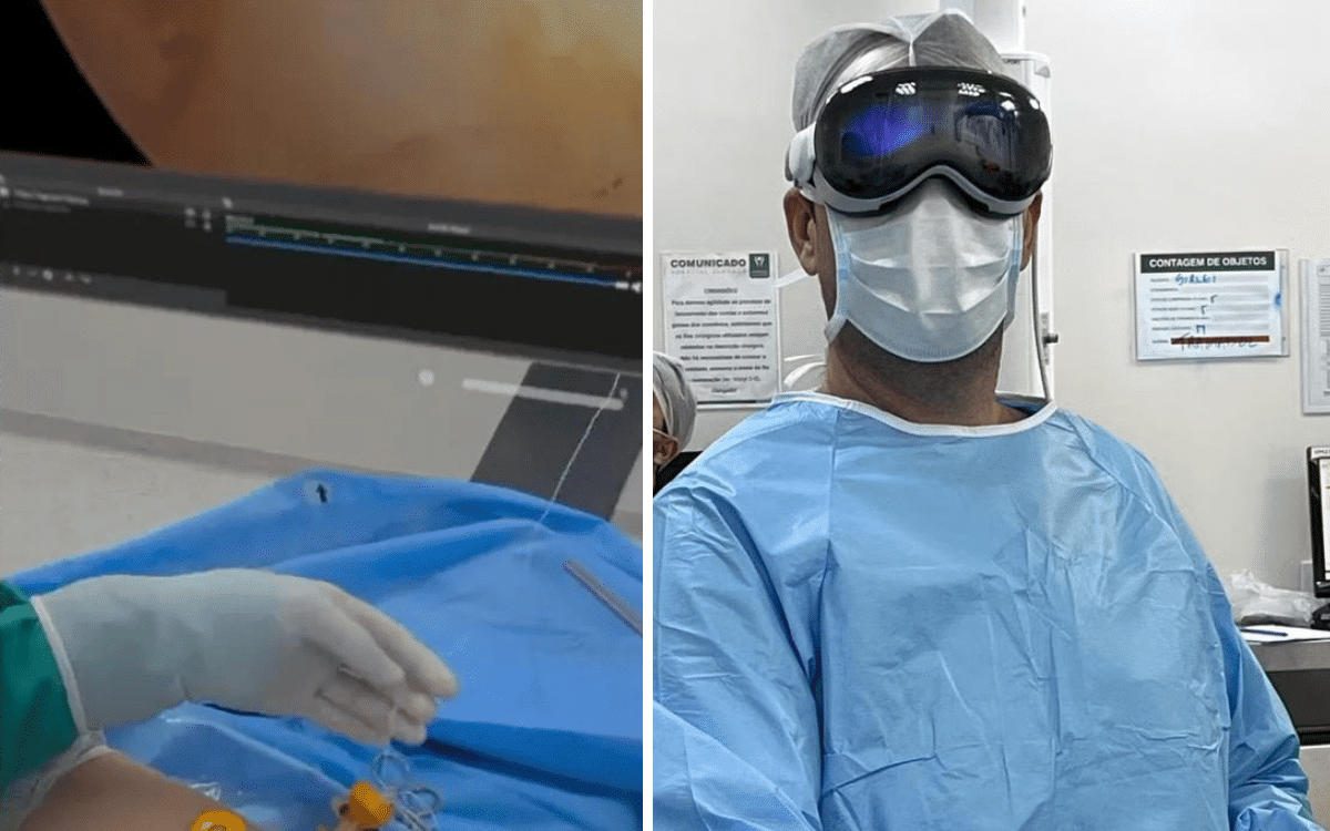 Doctor in Brazil used Apple Vision Pro for ‘game-changing’ surgery