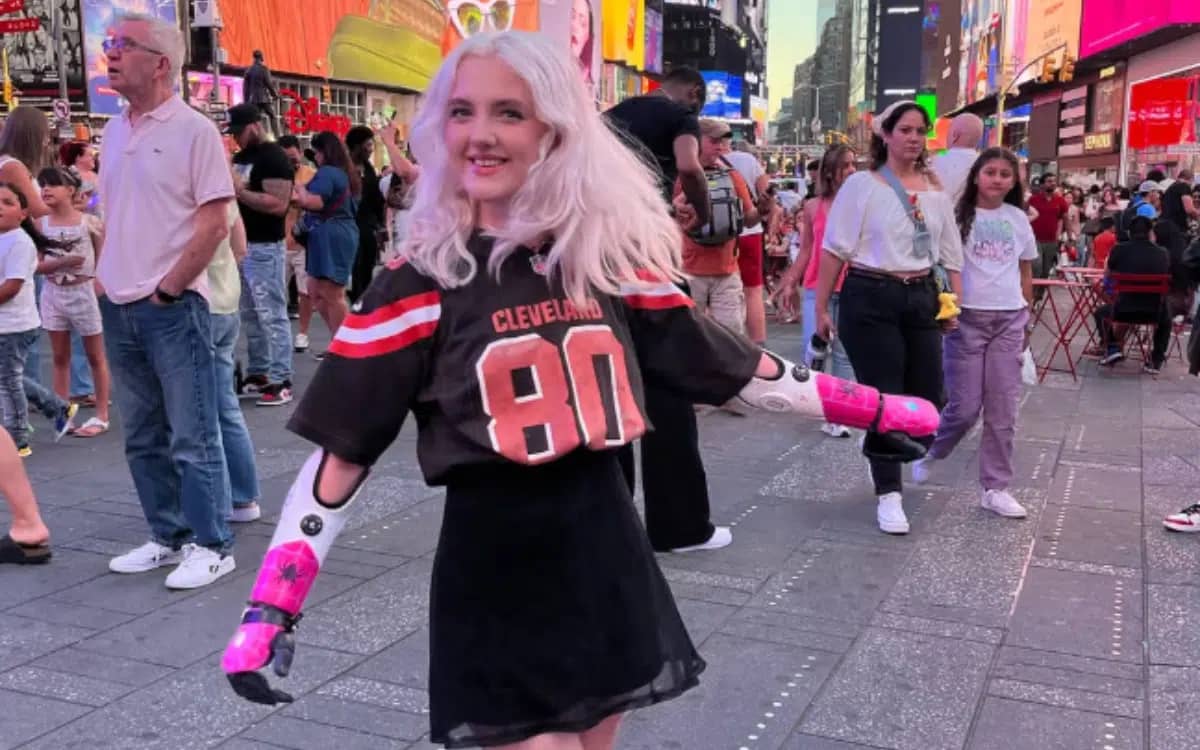 girl-has-mind-controlled-advanced-bionic-arms-tilly-lockey