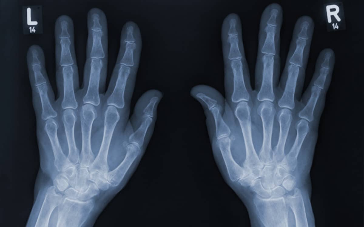 The life-saving x-ray was discovered completely by accident in a German lab