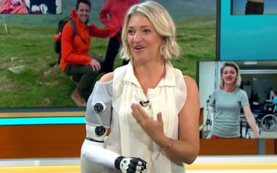 british-woman-claims-shes-80-human-and-20-robot-bionic-arm