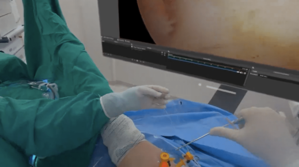 Doctor in Brazil used Apple Vision Pro for 'game-changing' surgery