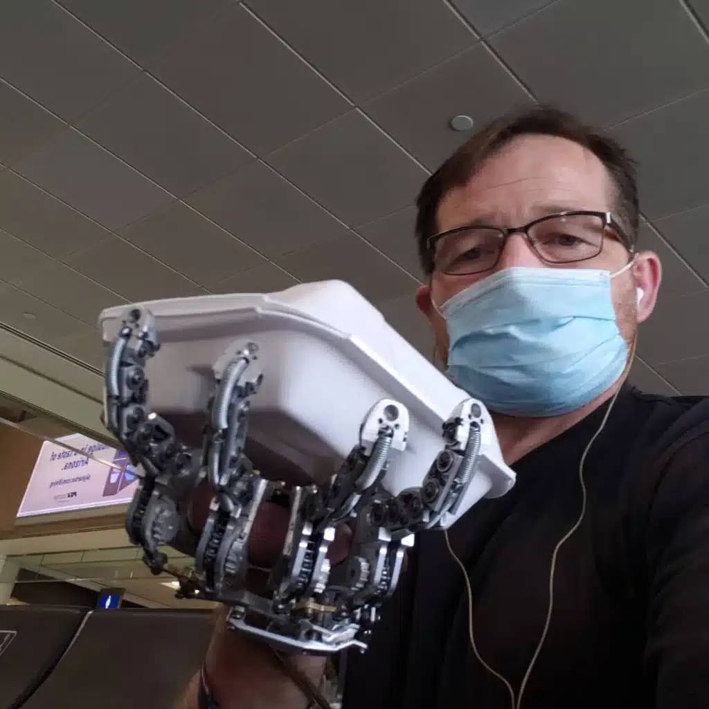 mechanical DIY prosthetic hand ian davis