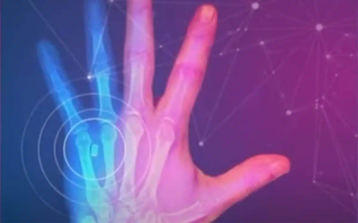 This company wants you to implant their microchip inside your hand
