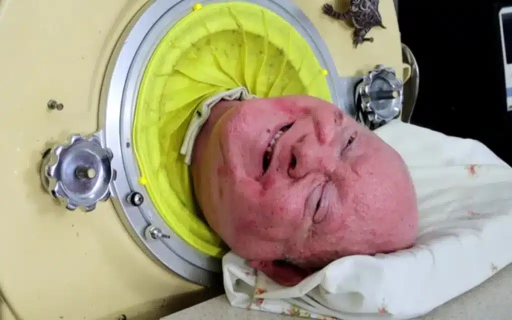 Man who lived inside iron lung for 70 years inspired millions by becoming a lawyer